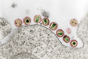 hiv virus under microscope