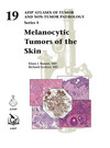 Melanocytic Tumors of the Skin